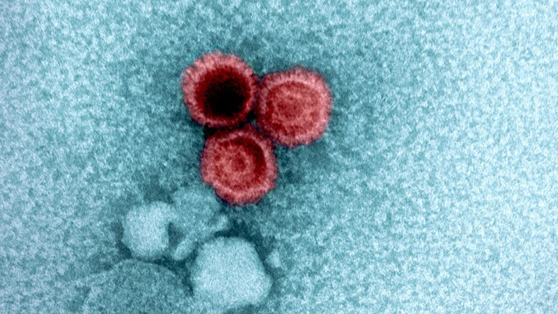 Anche il Dna umano determina se i virus restano nel corpo per anni