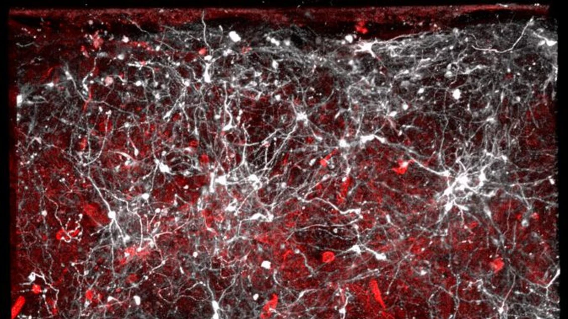 Cervello, la dopamina può alterare il senso di controllo e le decisioni