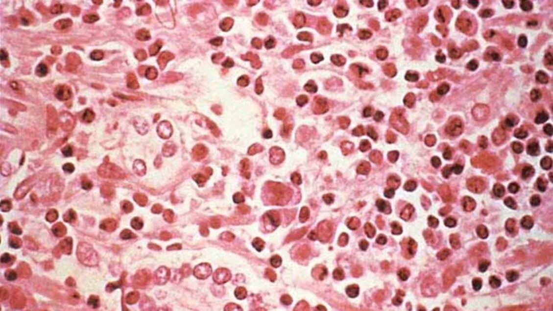 Così l'hantavirus si annida nell'organismo