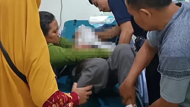 Pelajar Diduga Dianiaya Polisi hingga Tempurung Retak dan Koma, Begini Kronologi Versi Pol...