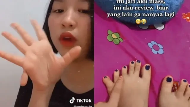 Kenali Penyebab dan Cara Menangani Polidaktili, Ketika Jari Tangan atau Kaki Lebih dari 10