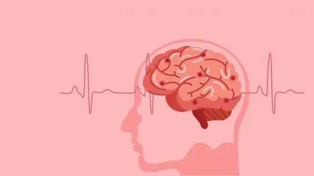 Saran Dokter untuk Mencegah agar Tak Terjadi Stroke Berulang