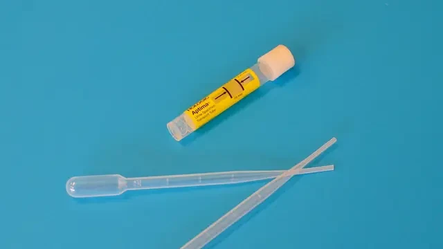 Teka-Teki 150 Tahun Kenapa Urine Berwarna Kuning Akhirnya Terpecahkan