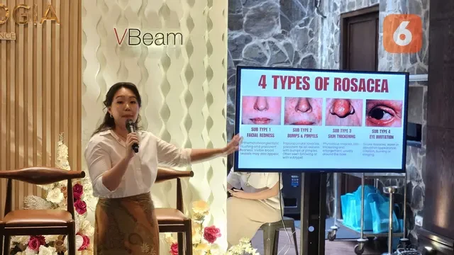 7 Fakta Rosacea: Penyakit Kulit yang Sering Dikira Jerawat Padahal Butuh Perawatan Khusus