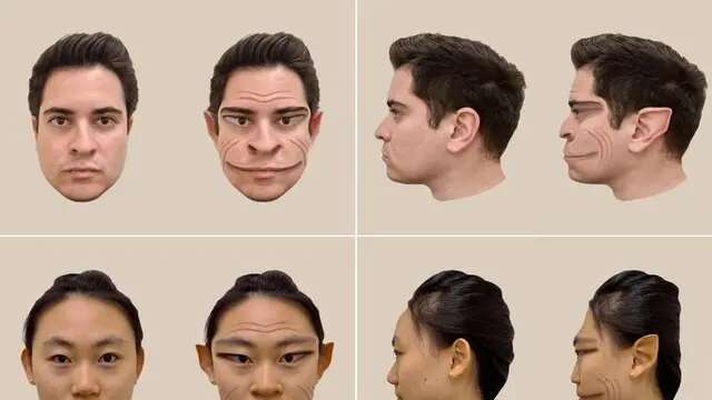 Pria Ini Terjangkit Demonic Face Syndrome, Gangguan Langka dengan Dampak Mengerikan