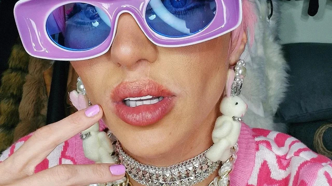 Manusia Barbie Asal Brasil Meninggal di Usia 31 Tahun, Ditemukan Bekas Luka pada Punggung ...