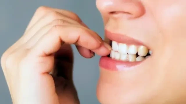 Hilangkan Sekarang Juga Kebiasaan Gigit Kuku, Ini Bahayanya bagi Kesehatan Anda