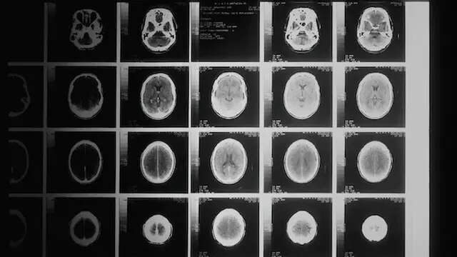 5 Penemuan dalam Sains yang Terjadi Secara Kebetulan