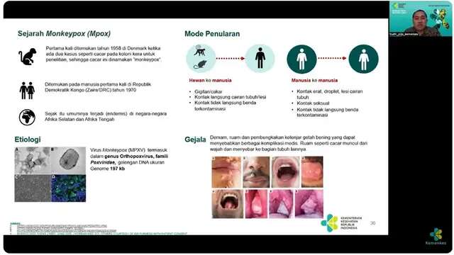 Mpox adalah Penyakit Akibat Virus Monkeypox, Pria Penyuka Seks Sesama Jenis Paling Berisik...