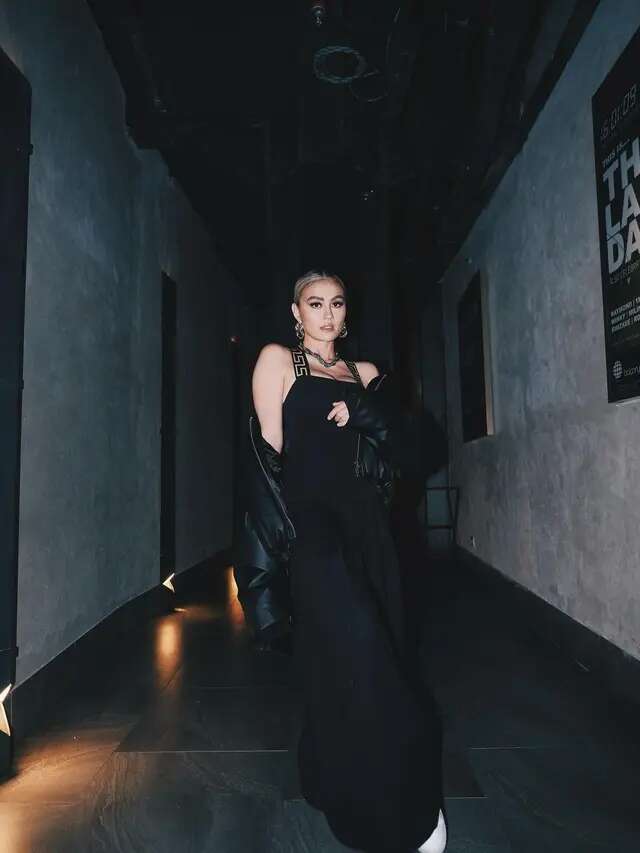 Cerita Agnez Mo Kena Alopesia Akibat Stres, Sel Darah Putih Menyerang Folikel Rambut Hingg...