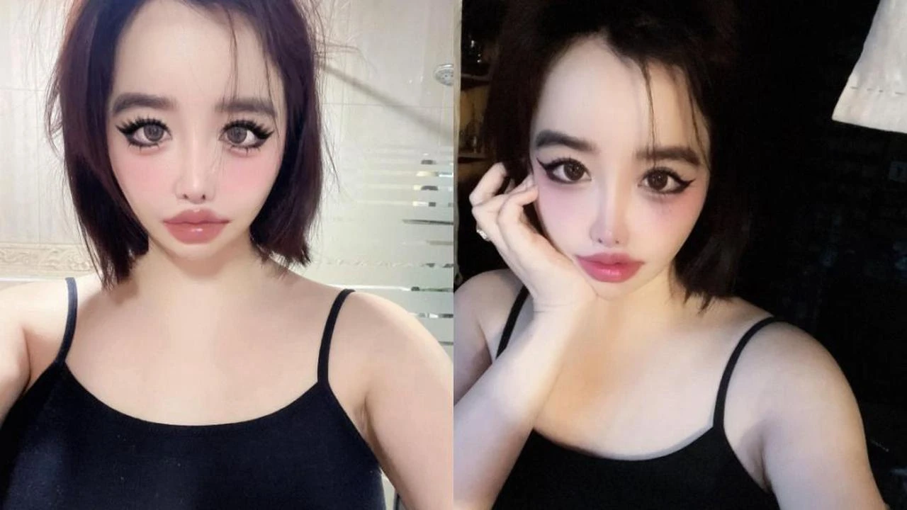 Park Bom Bantah Pernyataan Agensi soal Kesehatannya: Saya Baik-Baik Saja