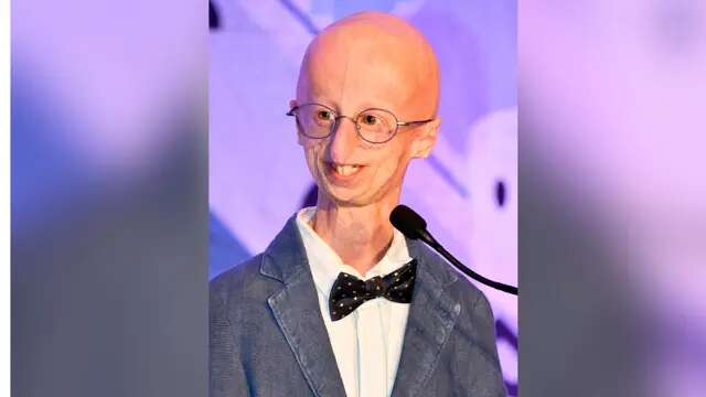 Sammy Basso Meninggal pada Usia 28 Tahun, Dulunya Aktivis dan Penyintas Progeria Terlama