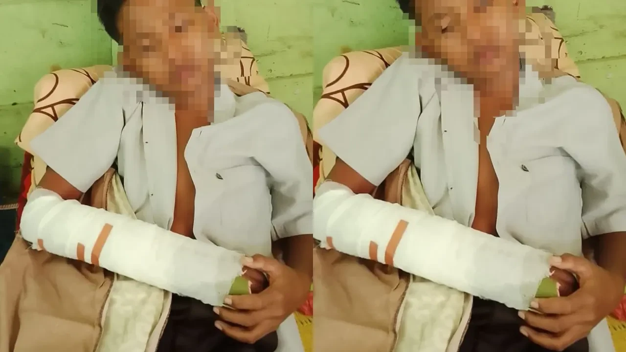 Ini Penyebab 2 Siswa SMP Berkelahi hingga Patah Tangan