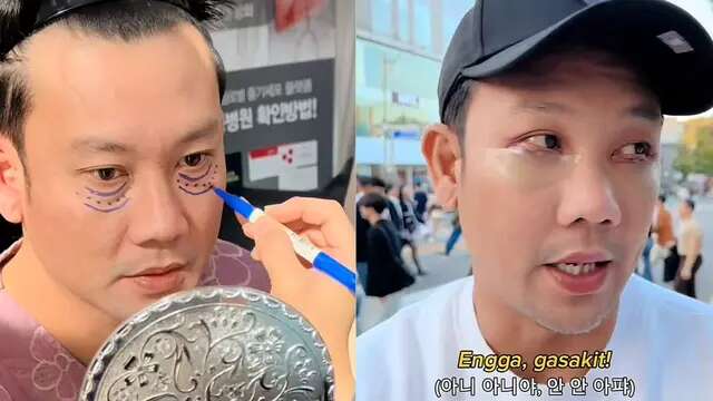 Dibujuk Istri, Denny Sumargo Jalani Prosedur Operasi Kantong Mata di Korea Selatan