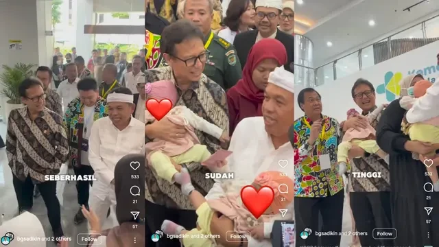 Menkes Budi Temui Pasien Kembar Siam yang Berhasil Dipisah di RSHS: Kondisinya Sehat
