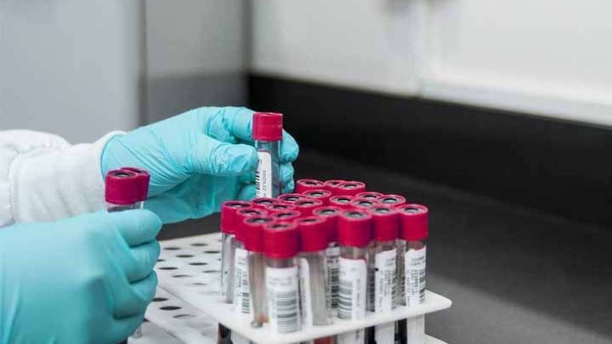 HIV após transplantes: sócios de laboratório já indenizaram mulher por erro semelhante