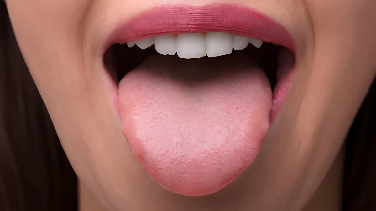 O lugar mais sujo da boca não é o dente