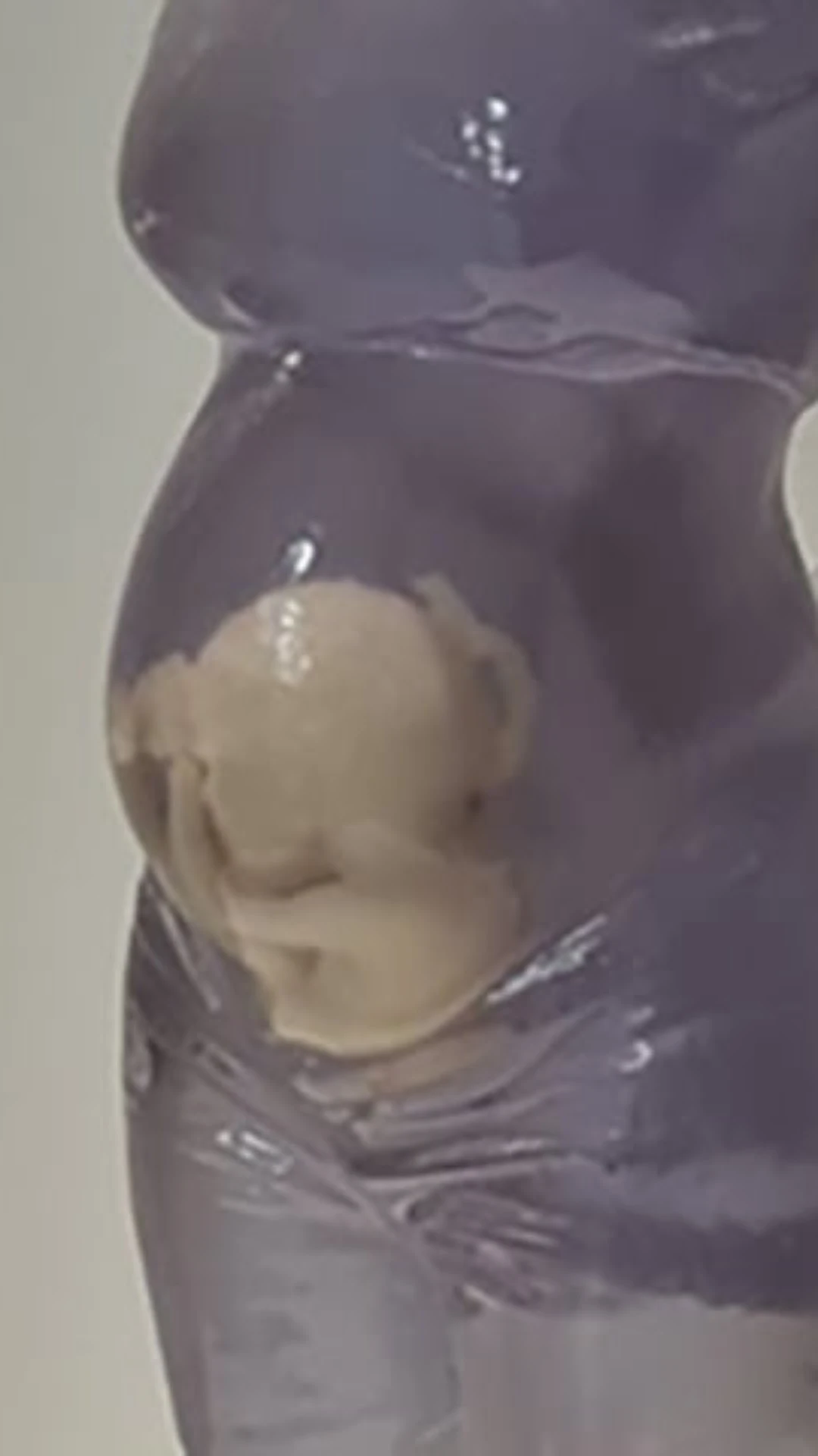 Nova tecnologia 3D mostra bebê em formação