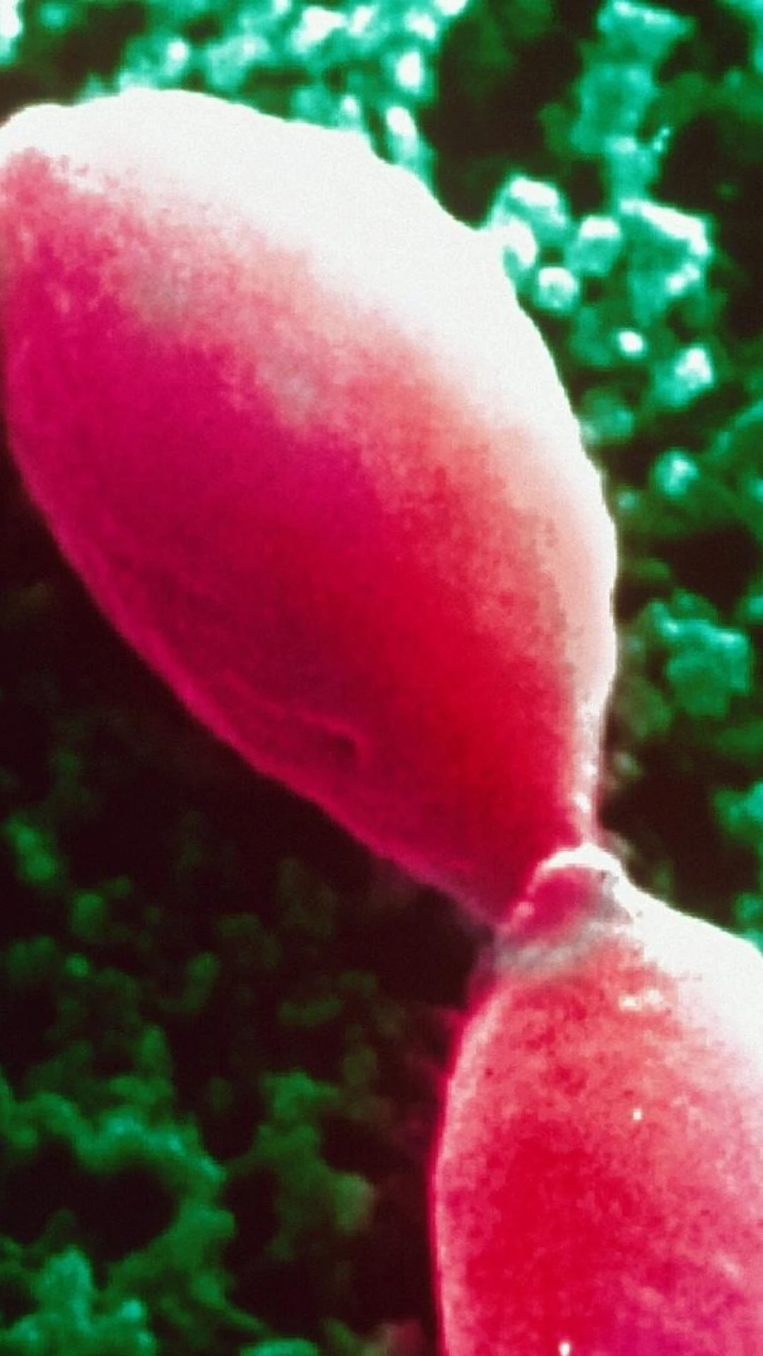 Parasita infecta um terço da humanidade, mas é negligenciado