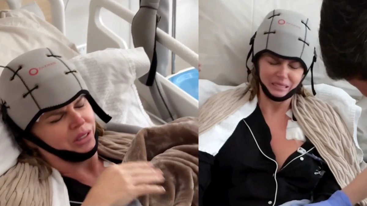 Touca usada na quimioterapia causa dor e tem eficácia variável