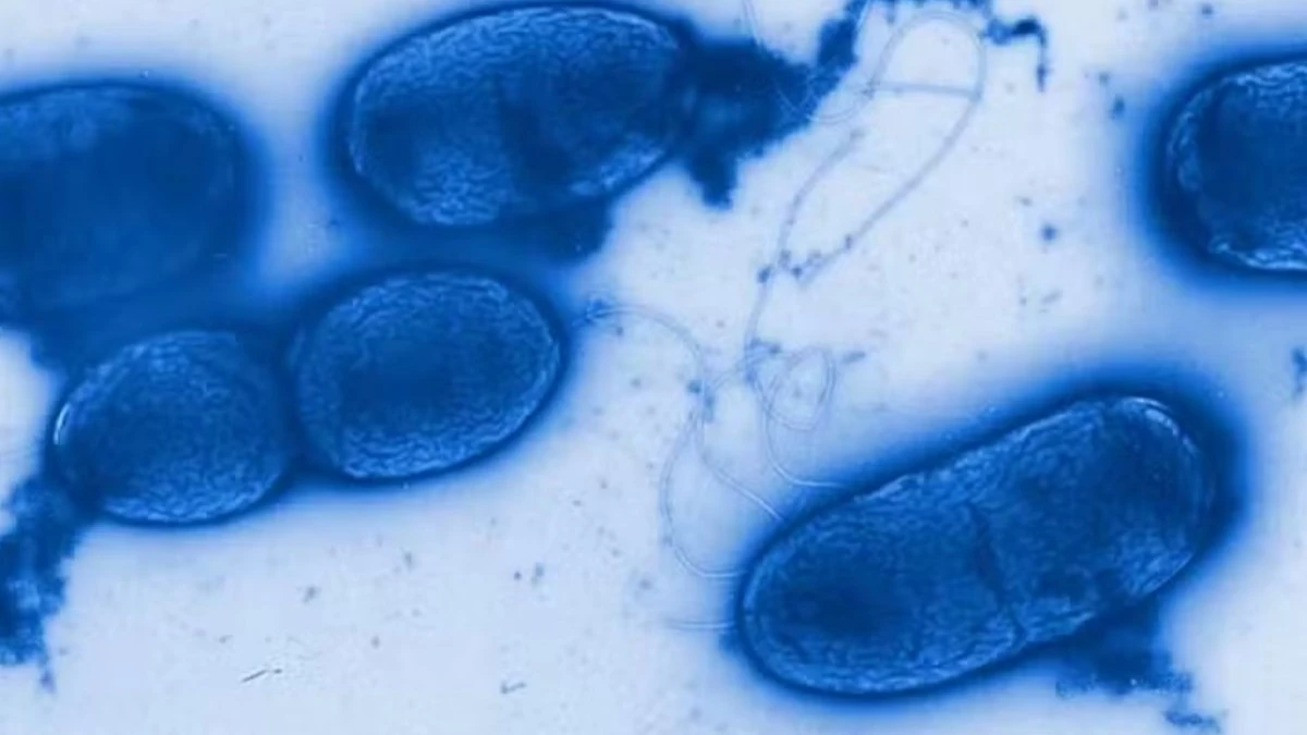 Pseudomonas: saiba qual bactéria foi encontrada na água Crystal