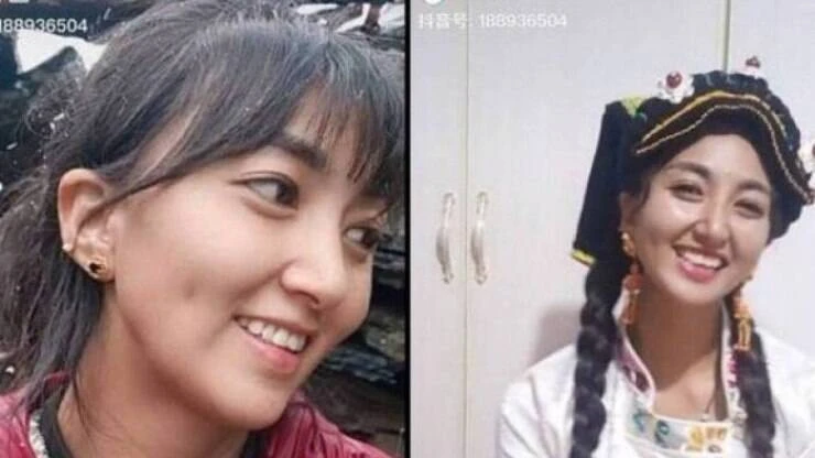 Homem não supera término e ateia fogo na ex-mulher durante transmissão ao vivo