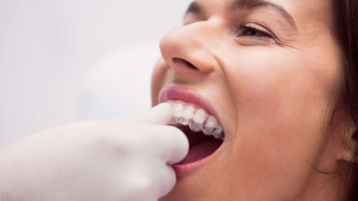 Oclusão dental: a importância de uma mordida correta