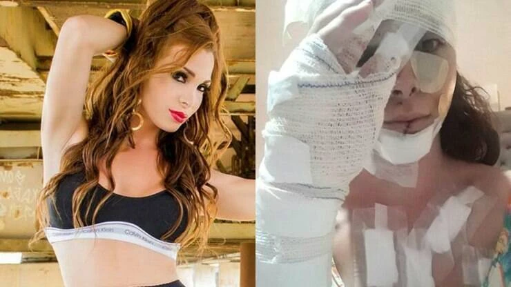Trans leva mais de 30 facadas após cliente tentar roubá-la; agressor está solto