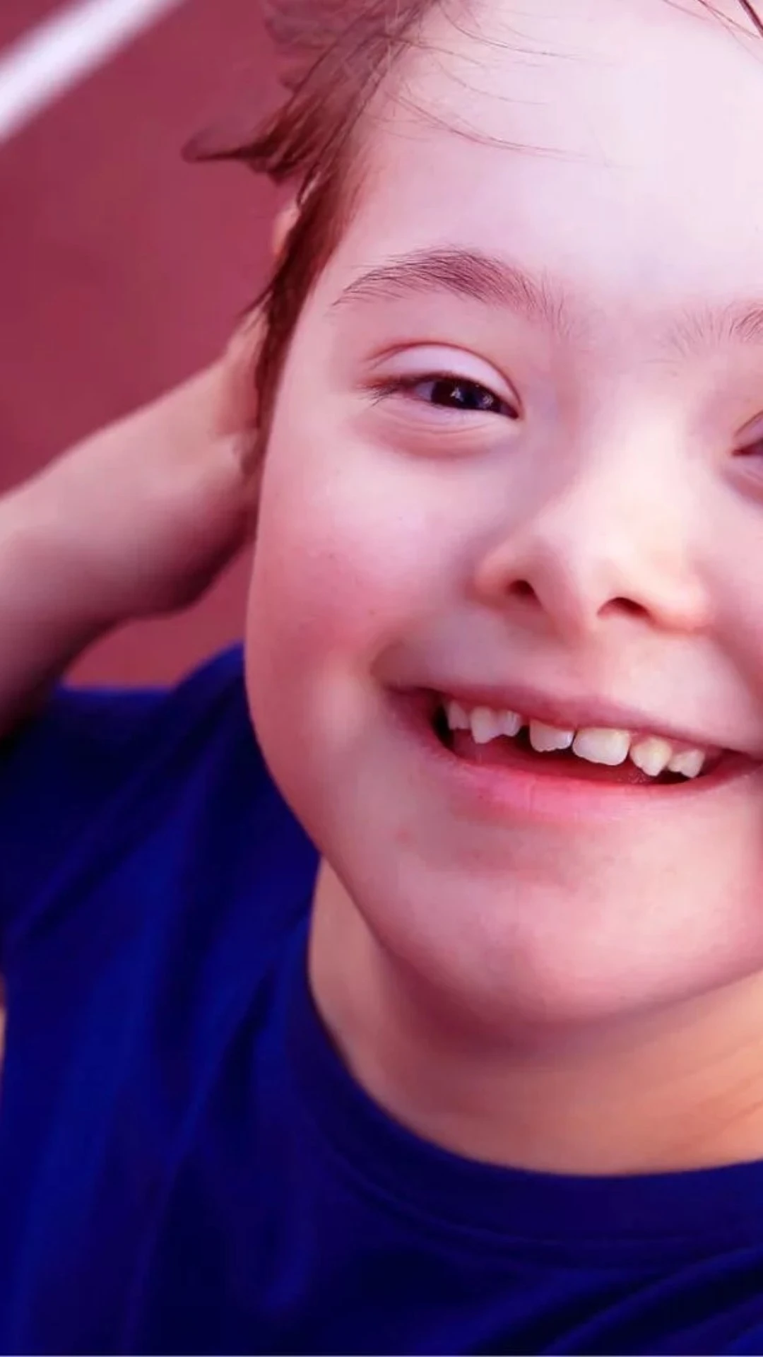 Dia Internacional da Síndrome de Down: Um farol de inclusão