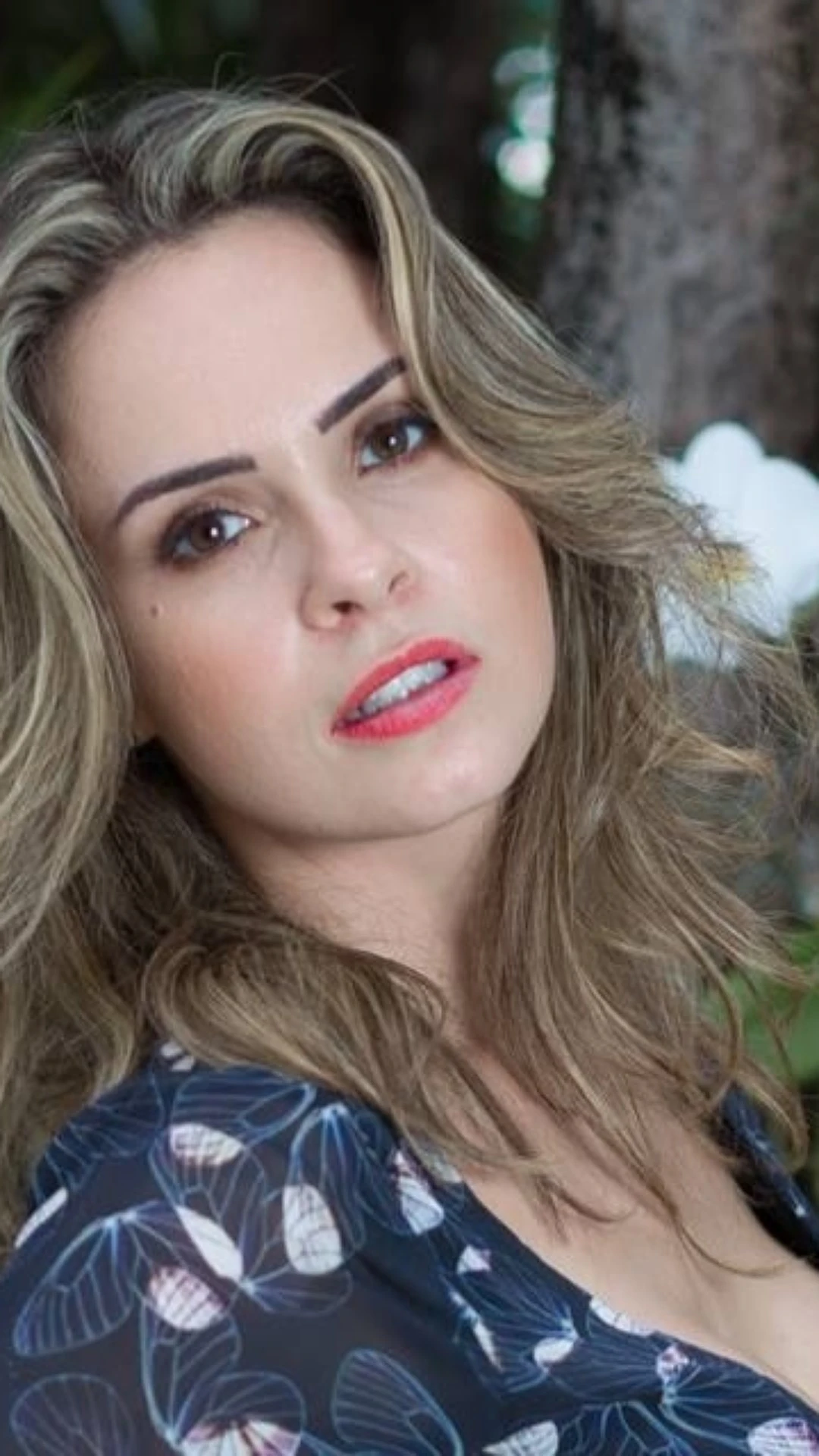 Ana Paula Renault passa por cirurgia de emergência: ‘Correu tudo bem’