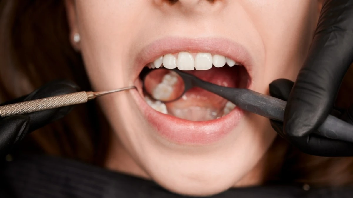 Vai
tirar o dente do siso? Confira os principais cuidados