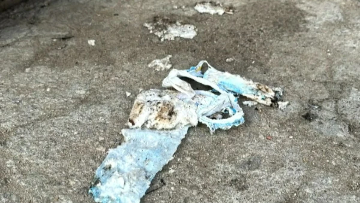RJ: bebê morre com 90% do corpo queimado após explosão com álcool