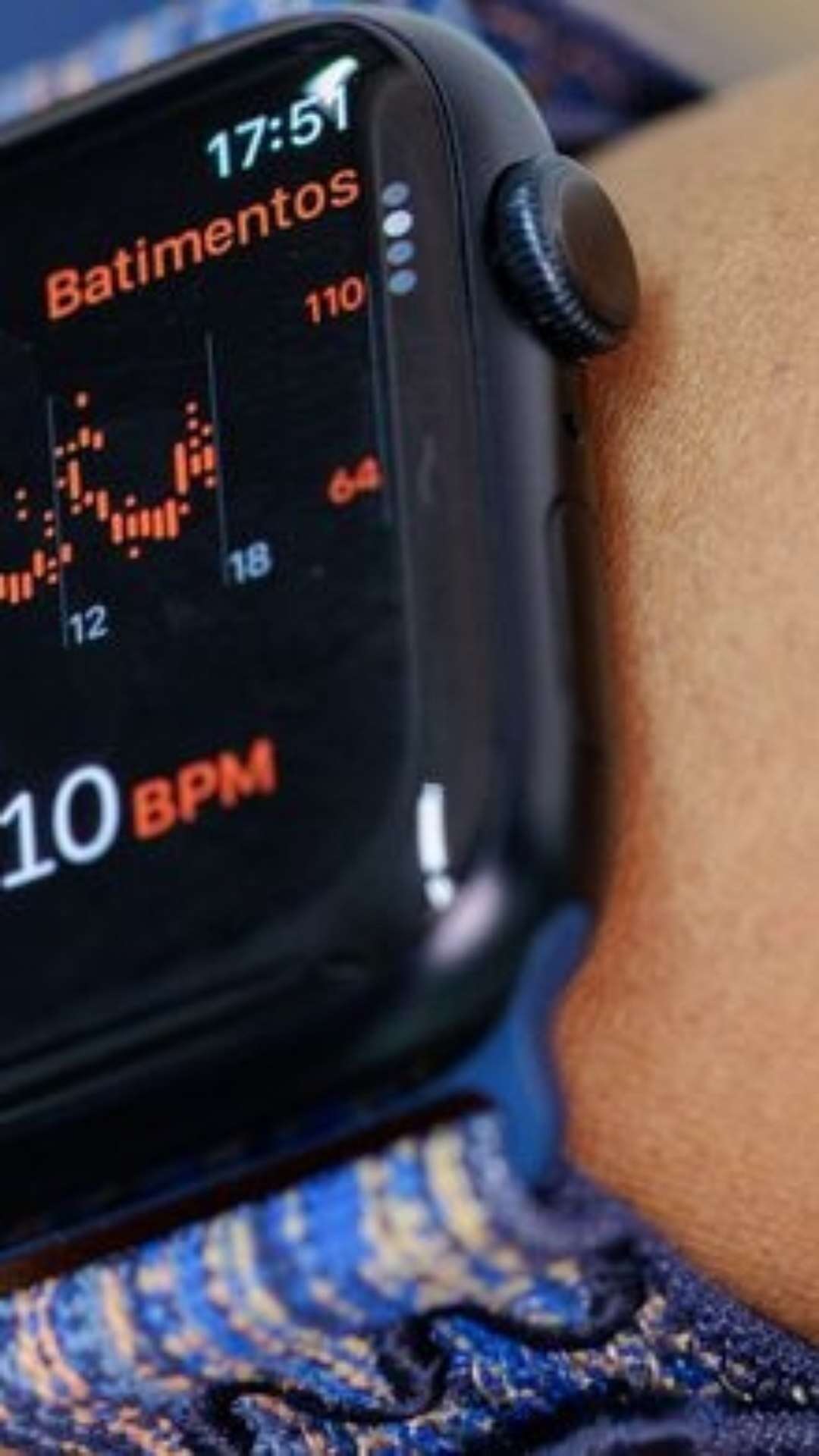 Próximo Apple Watch poderia medir temperatura interna do corpo