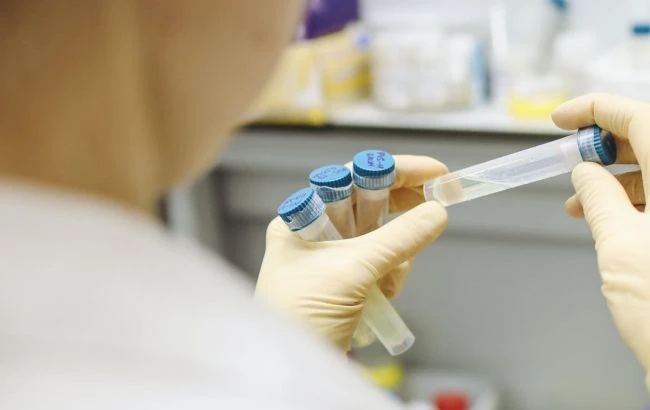 ВООЗ виявила, у які дні тижня реєструють найбільше нових випадків COVID-19