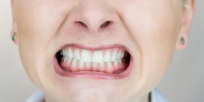 Bruxism adalah Kebiasaan yang Bisa Muncul Tanpa Sengaja Akibat Stres