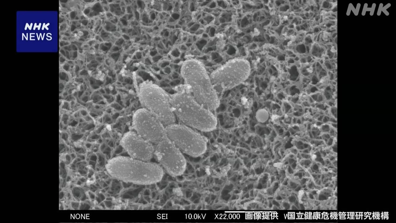 百日せき患者数 4日までの1週間に1746人 前週から減も流行続く