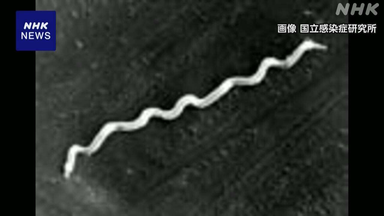 梅毒 去年の感染者数1万4663人 過去2番目の多さ 流行収まらず