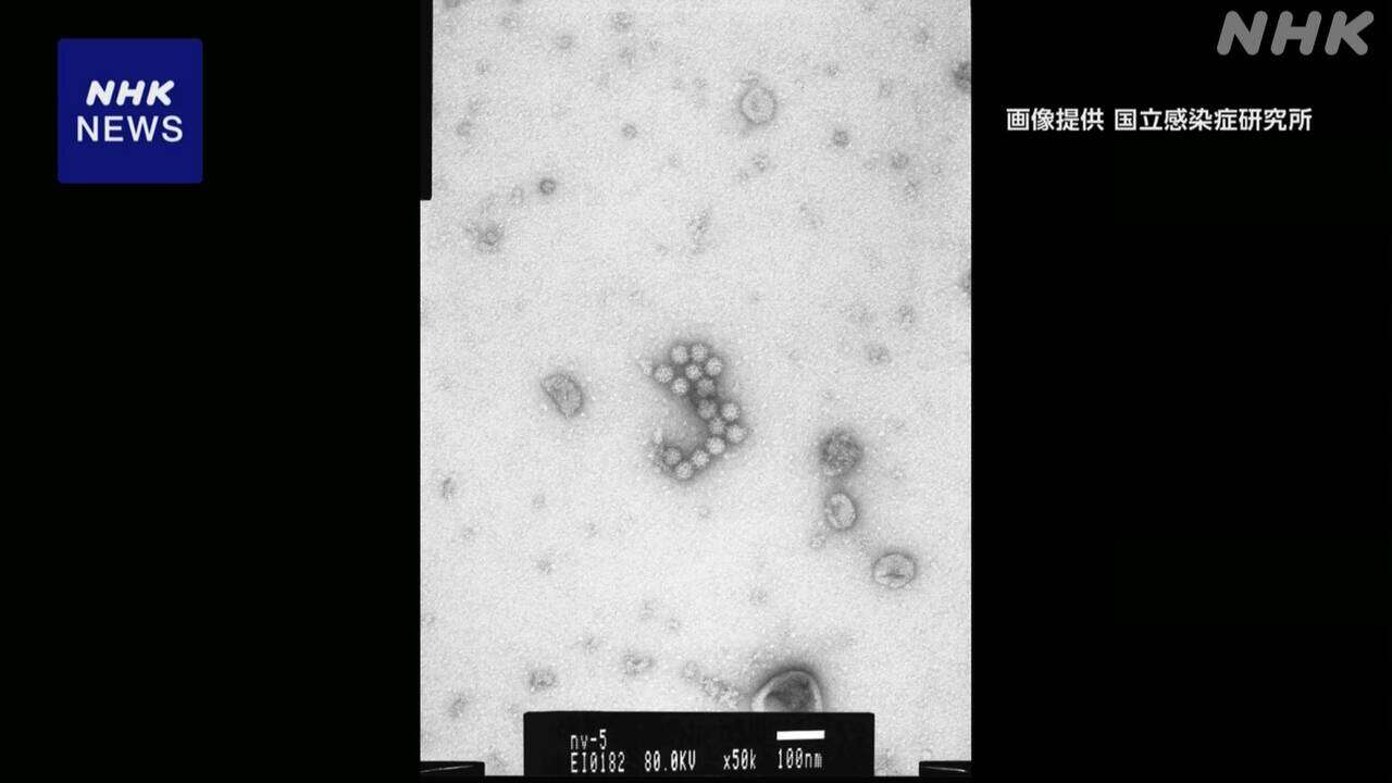 ノロウイルスなど 感染性胃腸炎の患者数 過去10年同時期で最多