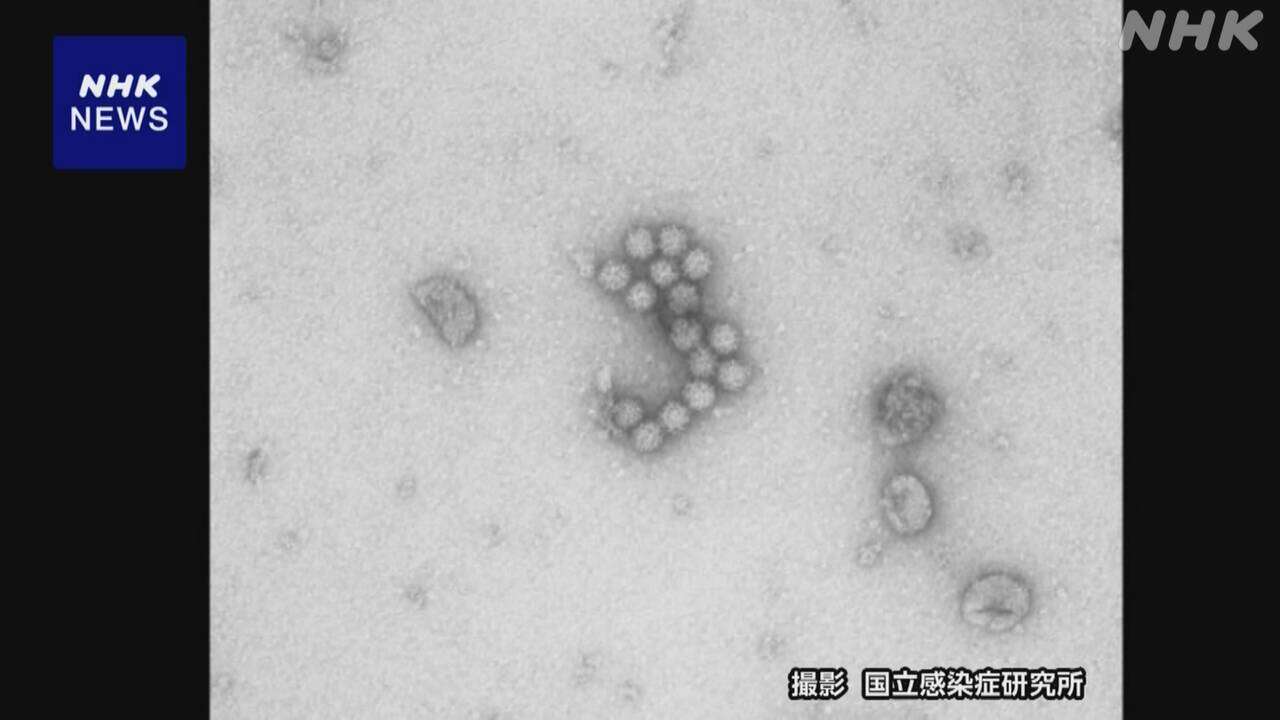 東京 中野 飲食店の弁当で81人がノロウイルスによる集団食中毒