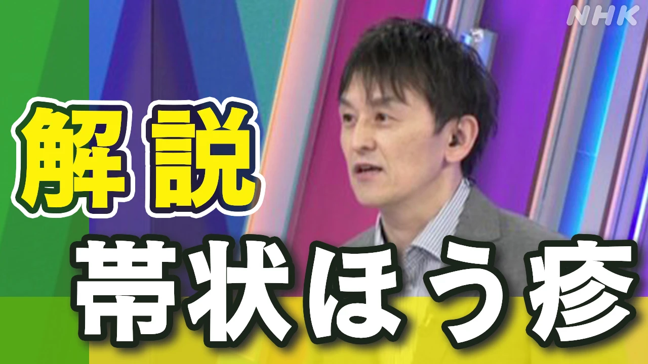 【動画解説】“帯状ほう疹”が増加 症状は？ワクチン補助は？