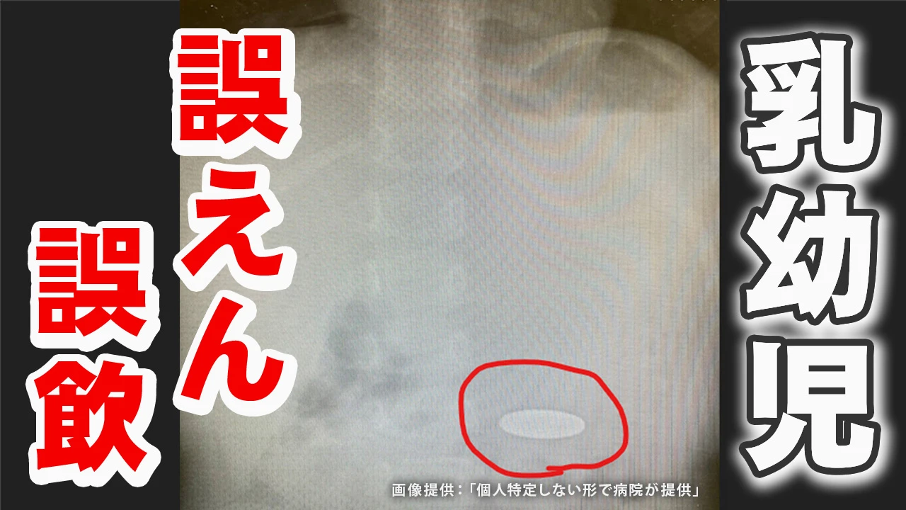 【Q＆A】 乳幼児の「誤えん・誤飲」なぜ起きる？対処法は？