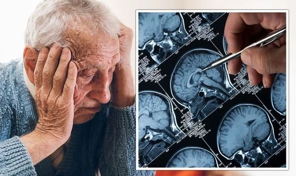 Alzheimer’s breakthrough as new algorithm 99% accurate at identifying brain changes