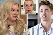 Abbie Quinnen unveils gruelling routine for burns to heal as AJ discusses 'bad days'