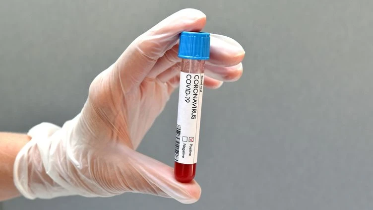 C'est ma santé. Un test sérologique pour éviter une seconde dose de vaccin contre le Covid si on a déjà été malade