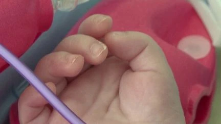 Intoxications alimentaires dans l'Aisne : la viande de deux boucheries analysée, deux nouveaux cas décelés chez des enfants