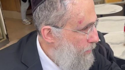 Rabbin agressé à coups de chaise à Neuilly-sur-Seine : 