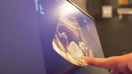 Santé : les échographies de confort, une pratique populaire mais illégale