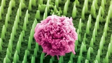 Tumori, un “cerotto” con nanoaghi per analisi in tempo reale. Anche senza biopsia