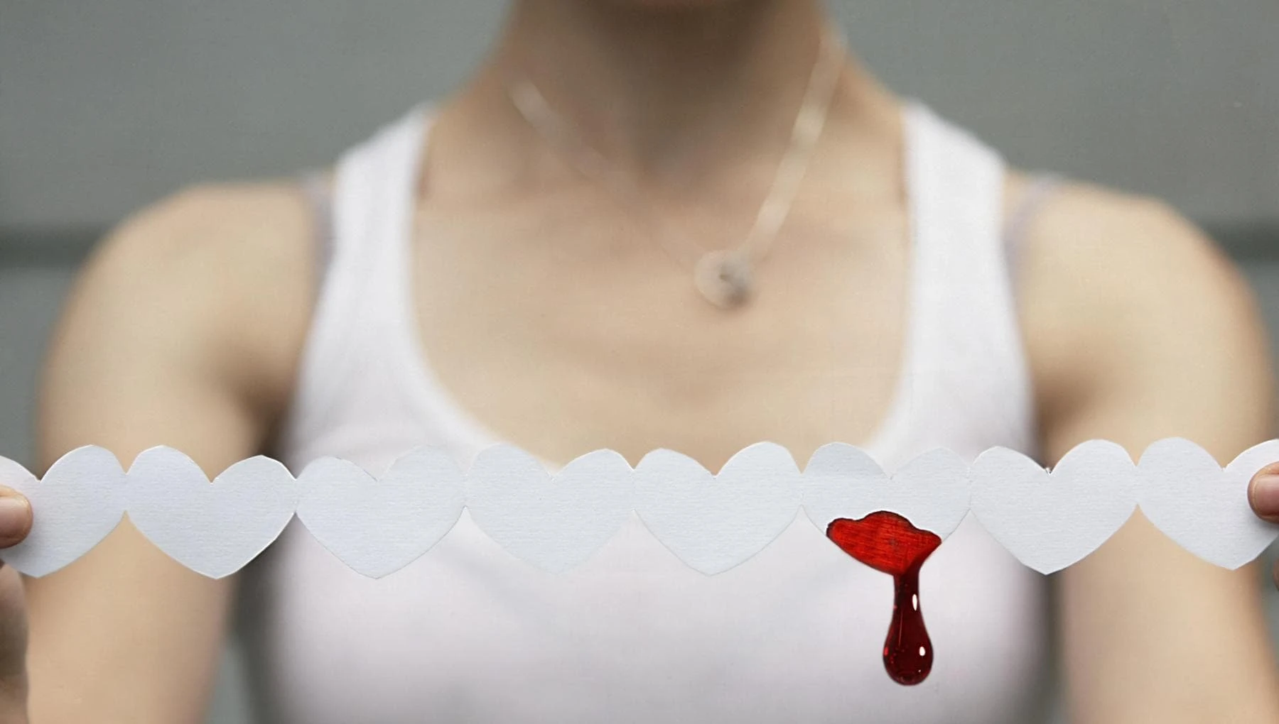 Emofilia, nella giornata l’appello: “Colpite anche le donne servono più studi”
