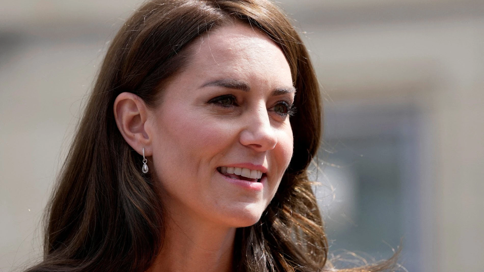 Kate Middleton operata di diastasi addominale. Che cos'è e quali esercizi fare per evitare la chirurgia
